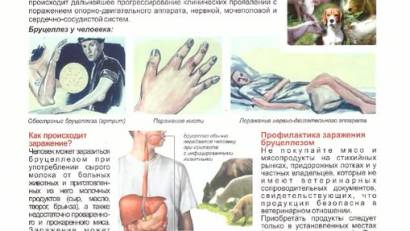Бруцеллёз